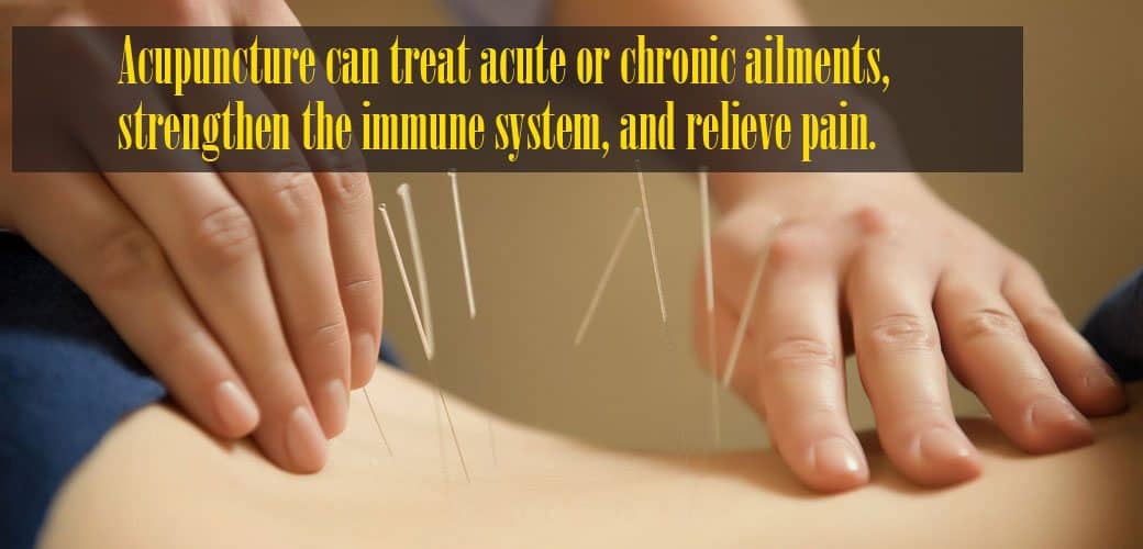 acupuncture in back