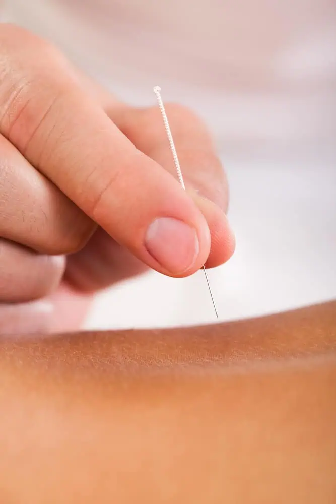 A close-up of a hand holding a thin acupuncture needle being inserted into the skin. The focus is on the needle and the person's fingers, highlighting the precision and delicacy of this pain management Long Island procedure.