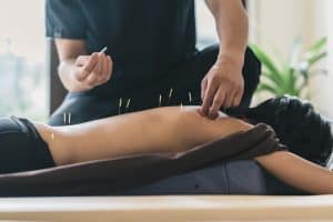 A person lies face down on a table receiving acupuncture treatment. A practitioner is seen inserting thin acupuncture needles into the person's bare back. The setting, typical of Acupuncture Long Island, appears to be a calm, indoor environment with soft lighting.