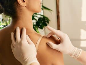 Reflexologist hand with acupuncture needle close-up during insert needle into a woman's shoulder for treatment. Acupuncture, reflexology