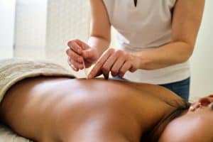 unrecognizable adult woman putting apucuncture needles in the back of unrecognizable young Ecuadorian woman lying face down and covered with towel on the spa table