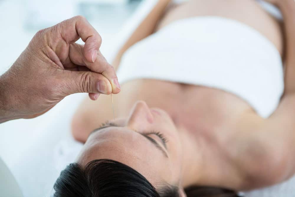 A person is lying down with their eyes closed, receiving acupuncture treatment. A hand is gently inserting a thin needle into the forehead. The person is wrapped in a white towel, suggesting a relaxing and calm environment.